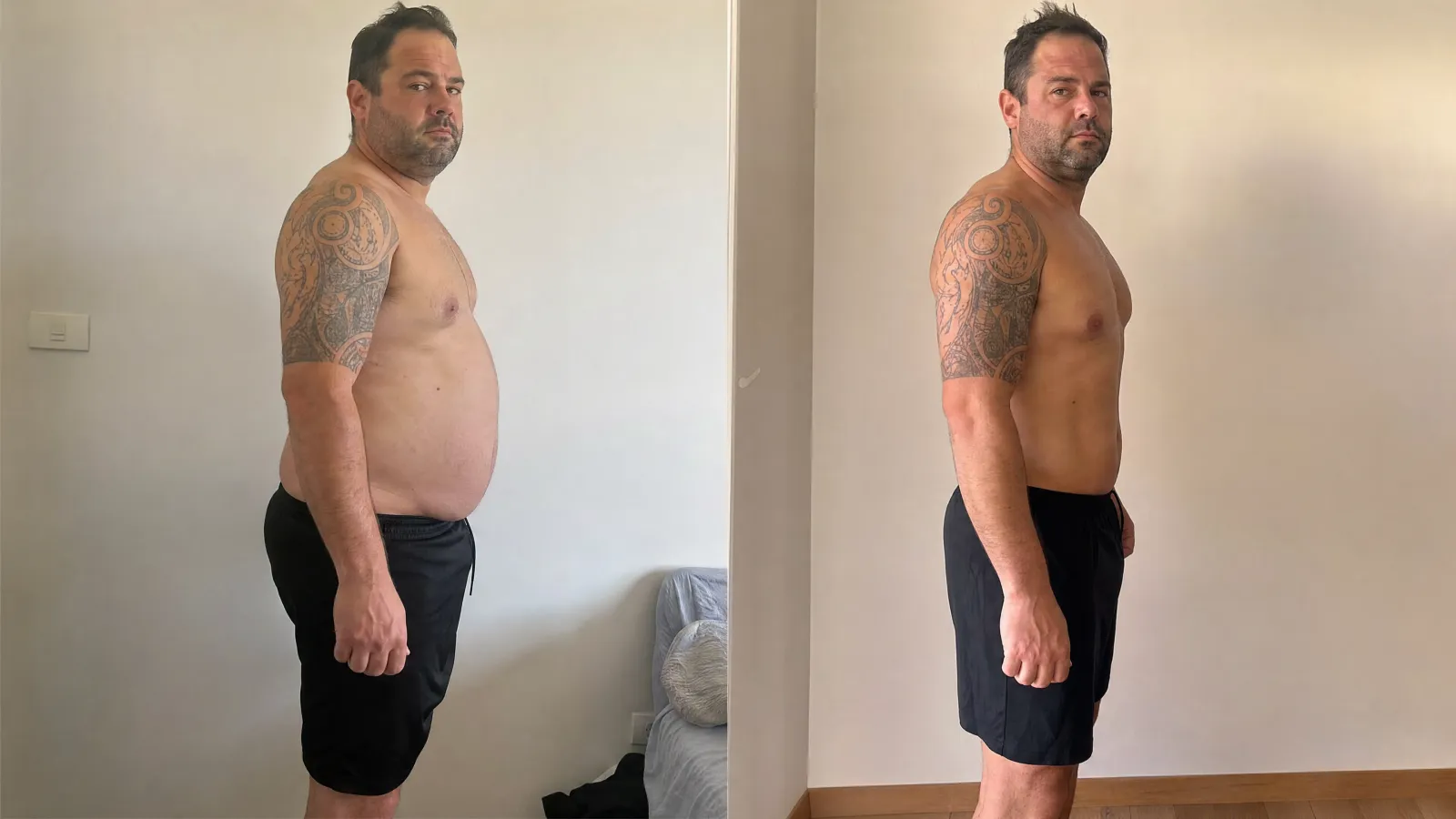 Patient before and after