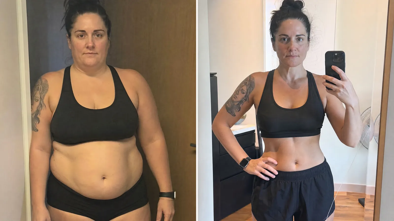 Patient before and after