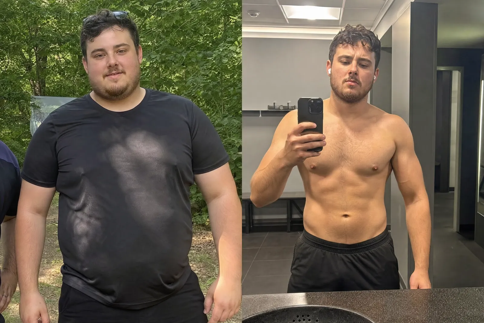 Patient before and after